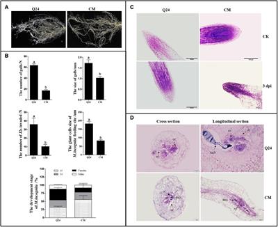 Transcriptomic and Histological Analysis of the Response of Susceptible and Resistant Cucumber to Meloidogyne incognita Infection Revealing Complex Resistance via Multiple Signaling Pathways